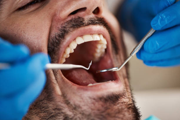 Best Emergency Gum Treatment in Peach Springs, AZ